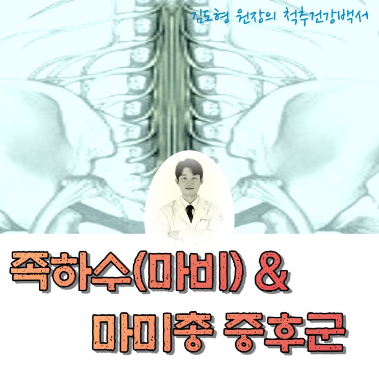 족하수, 마미총 증후군 이란? 마미총 증후군의 위험인자