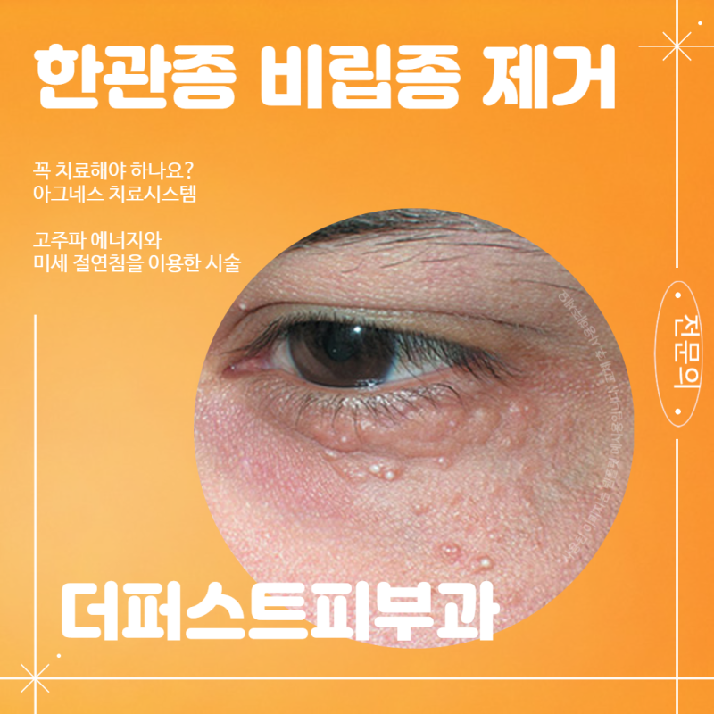 대구한관종 비립종과 같은 병변치료는 어떻게?