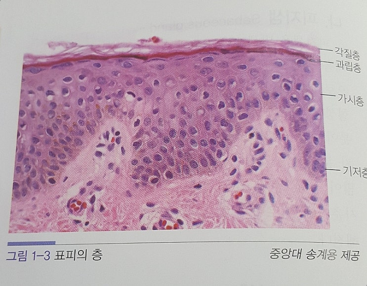  민감성 피부와 트라우마 분리하기, 관찰하기, 지금 이 순간