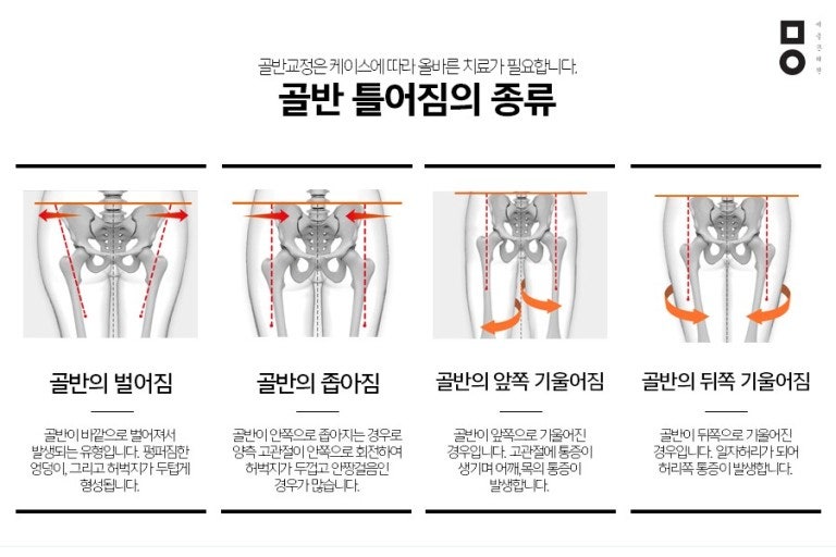 골반 틀어지는 선릉필라테스 자가진단! 3