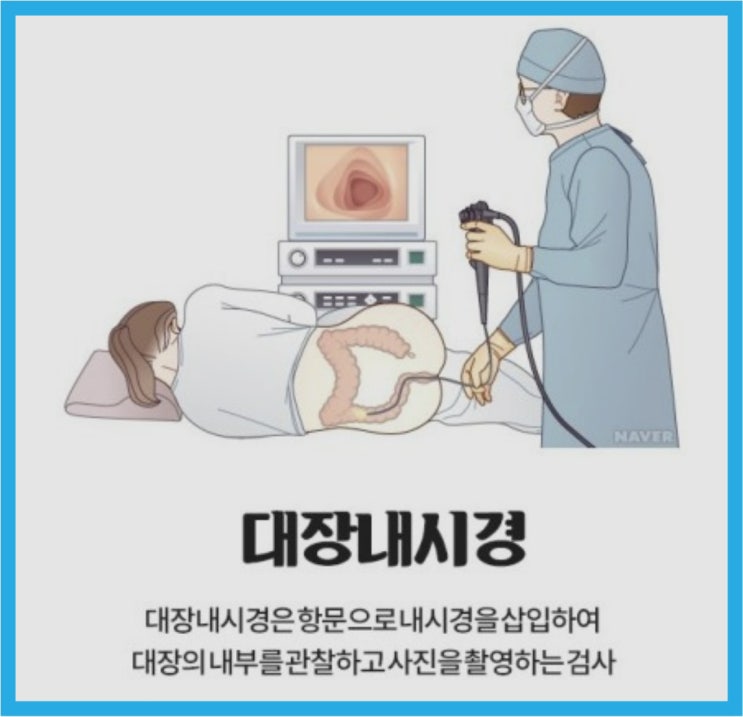  대장 내시경 전  음식, 2~3일전 권장 음식/피할 음식.