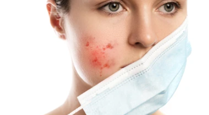 얼굴 접촉성 피부염,지루성 피부염 차이점과 관리법.