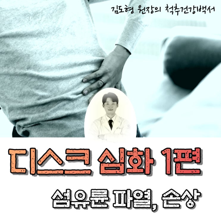 디스크 심화 1편. 디스크가 찢어졌어요 (섬유륜 파열에 대하여)