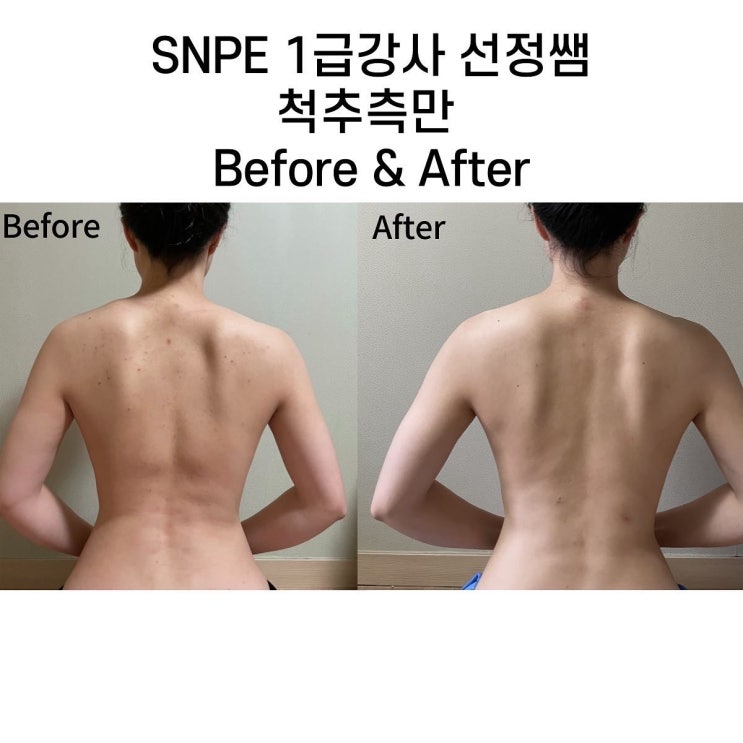  [대구SNPE] 1급 인증강사 선정쌤의 변화 - 측만