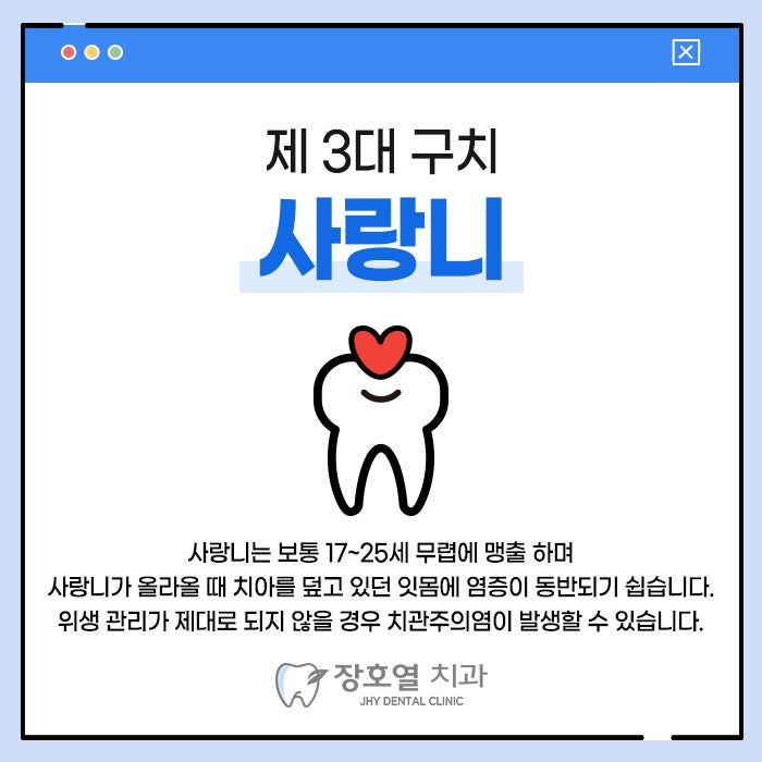 사랑니 발치 후 흡연/음주 당일 가능할까?