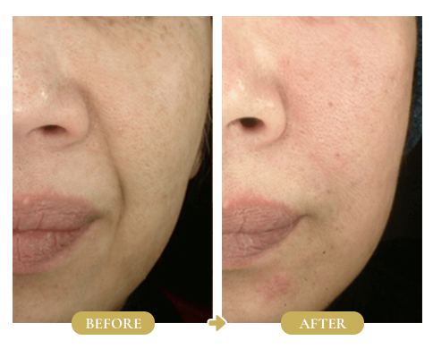  화장품 간헐적 단식(Skin Fasting)