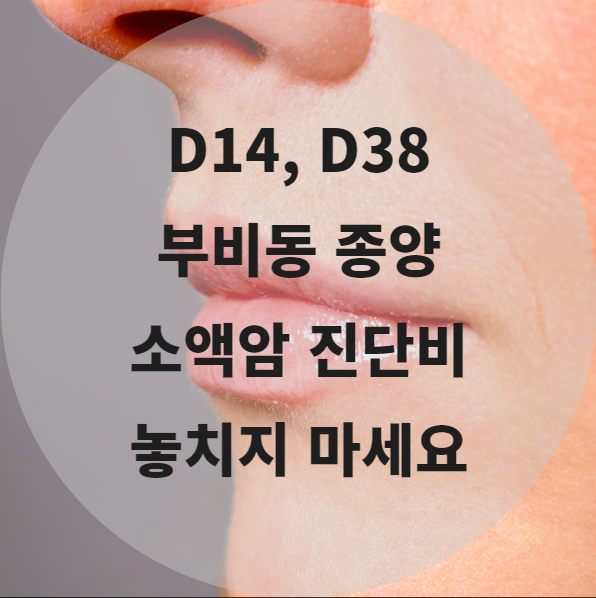 중이 비강 및 부비동의 양성신생물 D14 D38 소액암진단비 놓치지 마세요
