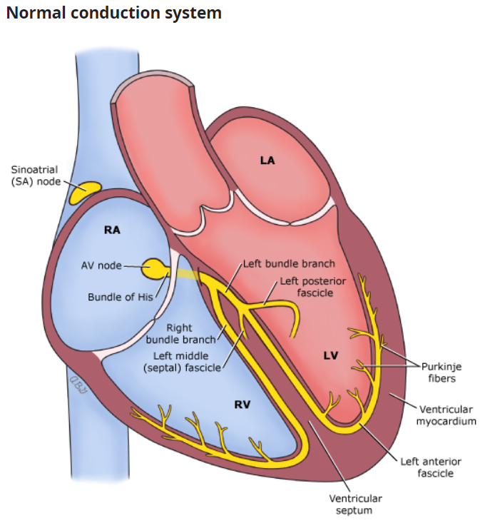 Bradycardia, 서맥, AV block 진단 및 치료