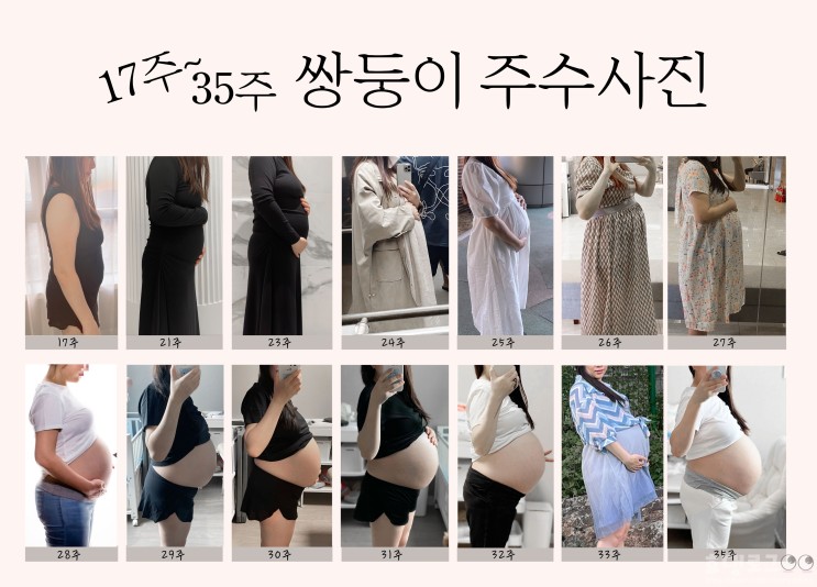쌍둥이 임신증상 4주~35주｜주수사진+초음파