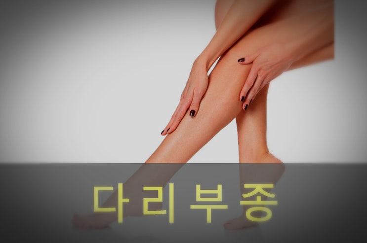  하체, 다리, 부종 원인과 증상, 예방, 좋은 차와 음식