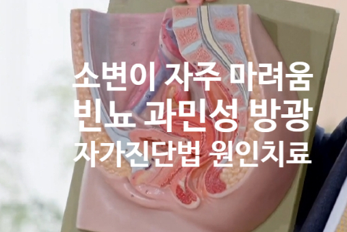  소변 자주 마려움 방광염 (ft. 과민성 방광 자가 진단법 /원인 증상 해소 방법)