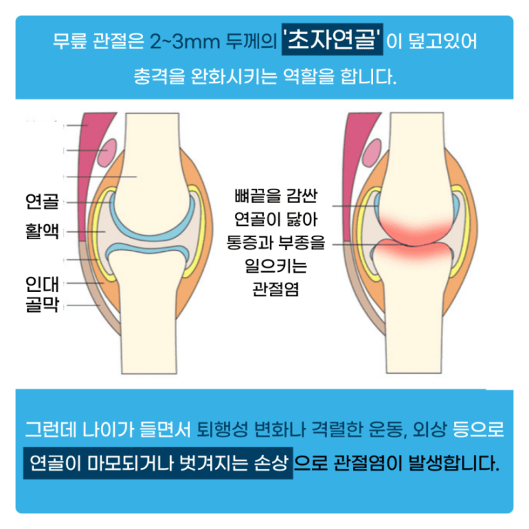  염증에 좋은 약초 금과도 바꿀 수 없는 약초는?