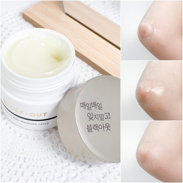 팔꿈치 겨드랑이 색소침착 관리 뷰티영 블랙아웃 프리미엄 바디 화이트닝 미백크림 팔꿈치 겨드랑이 색소침착 관리 뷰티영 블랙아웃 프리미엄 바디 화이트닝 미백크림