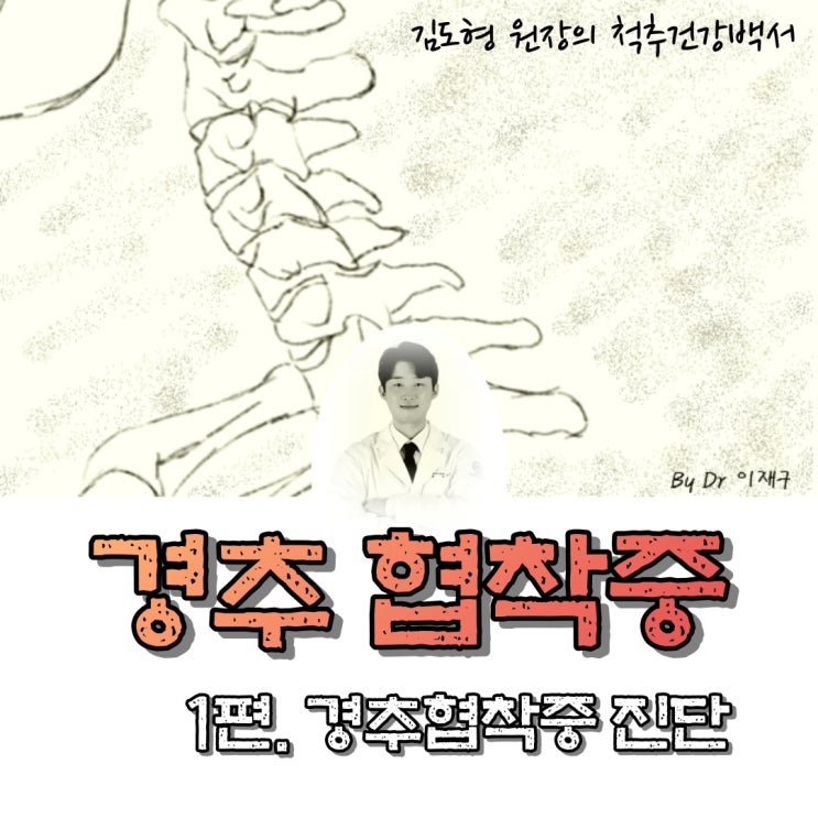  경추 협착. (경추협착증 이란? 중심성 경추 협착증의  분류)