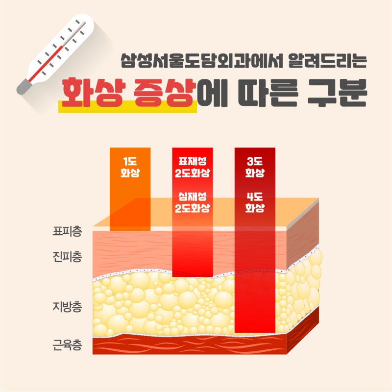 수원외과의원의 오래된 화상상흔도 화상클리닉으로 개선을