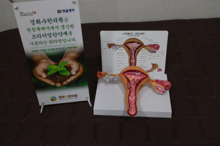  수원생리통 기형종 증상과 치료를 알아야
