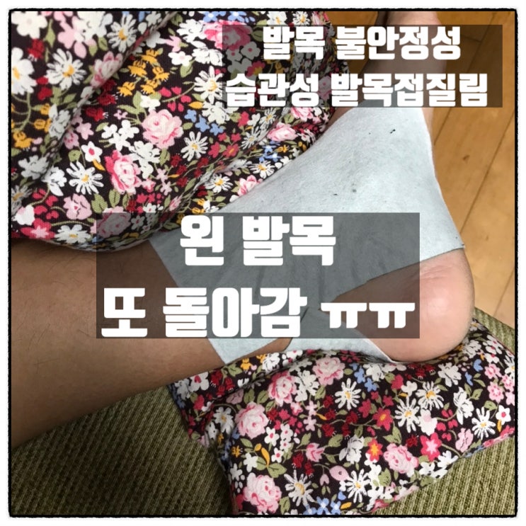 발목불안정성 습관성 발목 접질림 만성 발목불안정증 왼쪽 발목 또 돌아감 발목불안정성 습관성 발목 접질림 만성 발목불안정증 왼쪽 발목 또 돌아감
