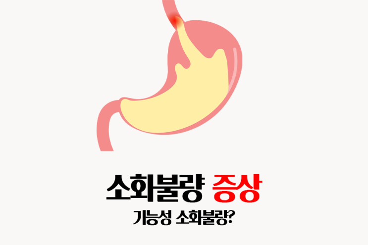  기능성 소화불량 증상