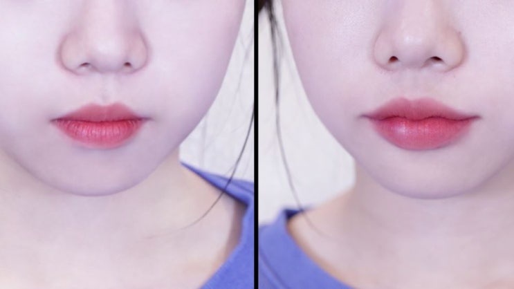  뷰티라운지의원동탄 시간은 없고 빨리 티 나게 예뻐져야 할 때