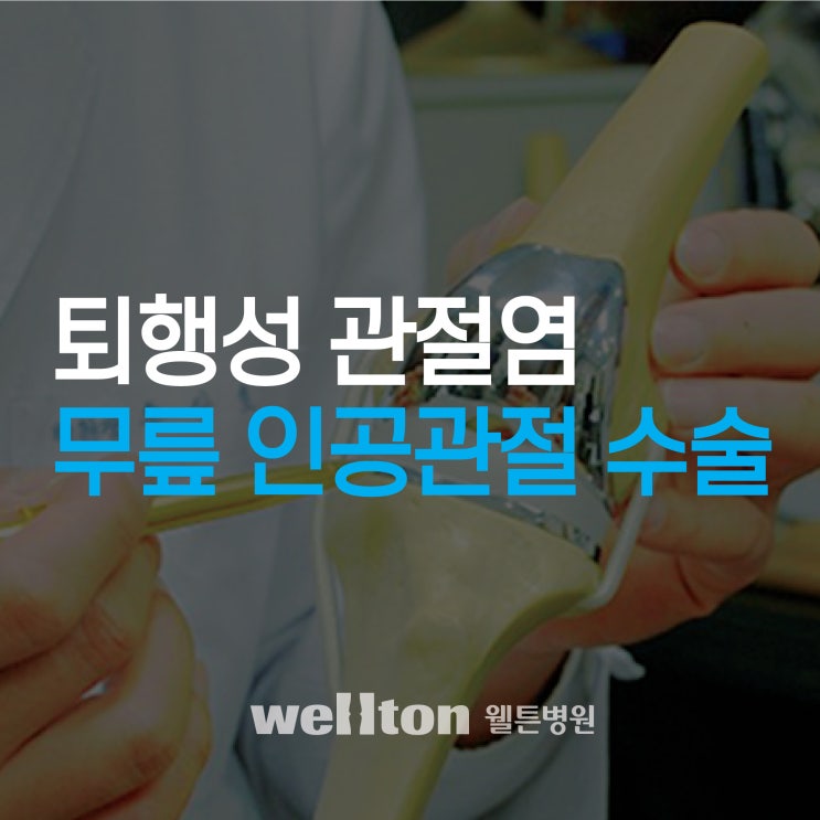  마곡동무릎병원 퇴행성 무릎 관절염의 진행단계와 치료방법
