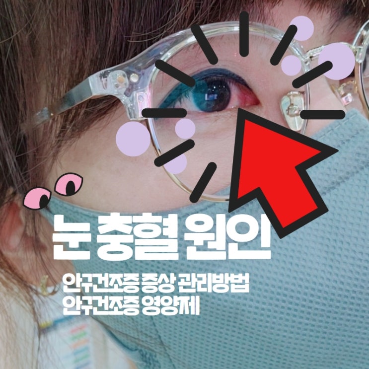 눈충혈원인 필요한건 안구건조증영양제 눈충혈원인 필요한건 안구건조증영양제