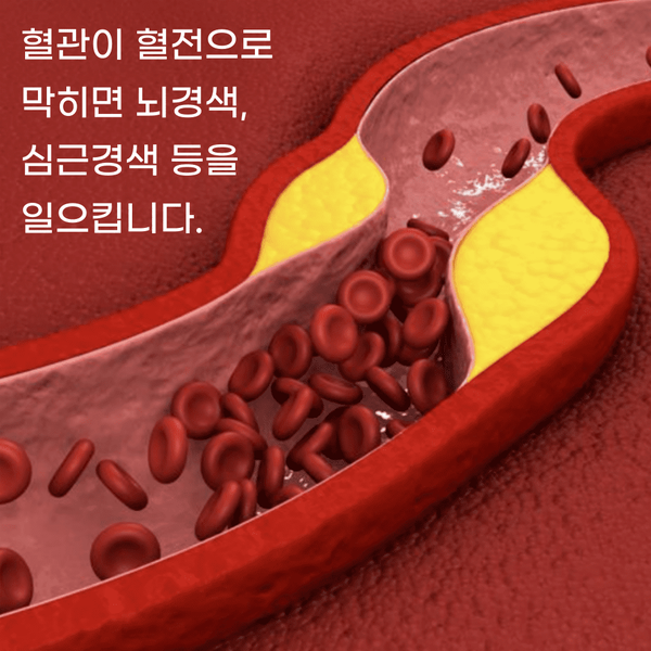  혈전뜻 이 무엇이고 혈전약 고르는 방법이란?