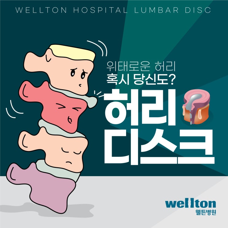  발산동신경외과 방치하면 위험한 허리디스크 원인!