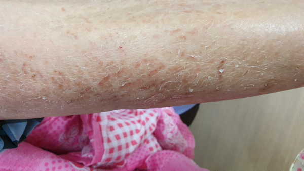 ‘요양원 우리 아빠, 어쩌다 이 지경’… 속타는 자녀들 ‘요양원 우리 아빠, 어쩌다 이 지경’… 속타는 자녀들