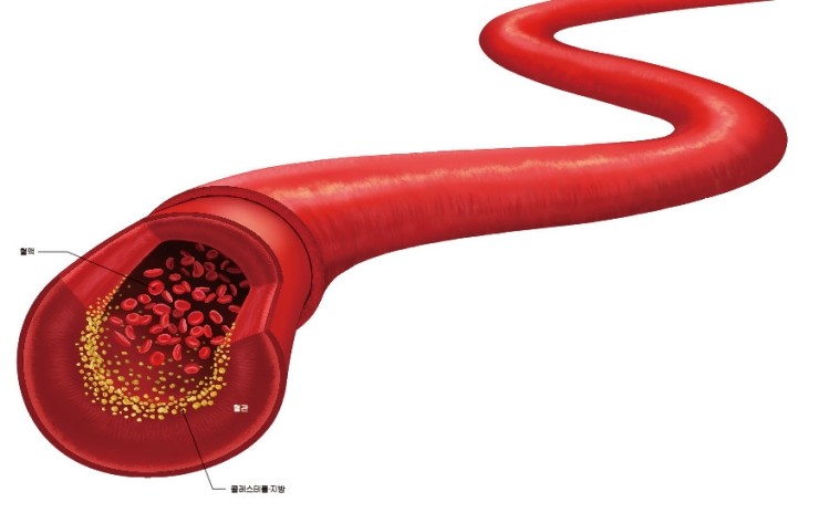 혈관을 깨끗하게 유지하기 위한 다섯 가지 방법
