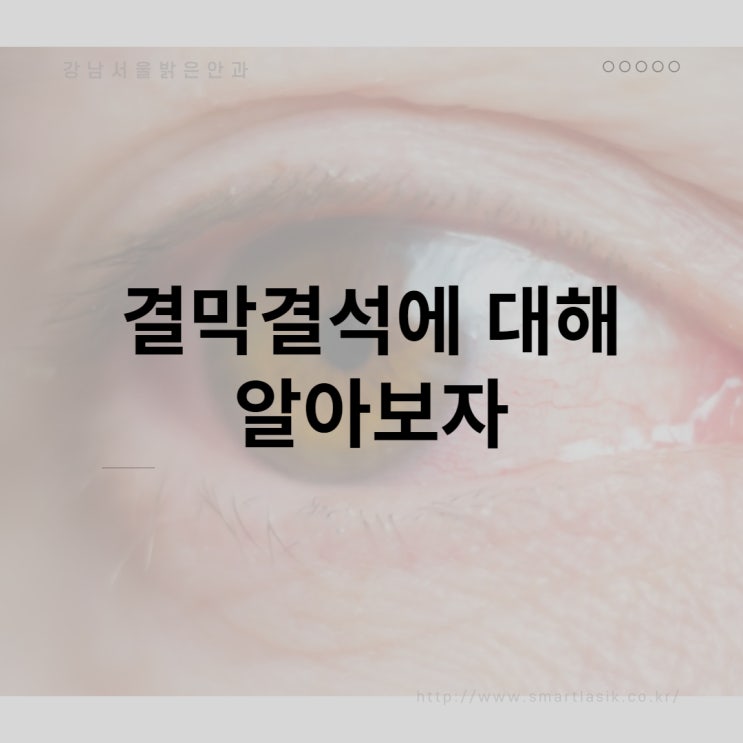  결막결석원인과 치료방법, 예방방법  눈에 돌이 생길 수 있나