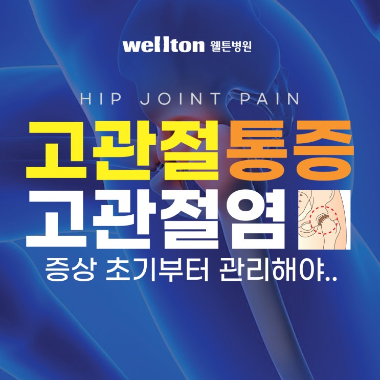  가장 흔하게 발생하는 고관절염, 퇴행성고관절염