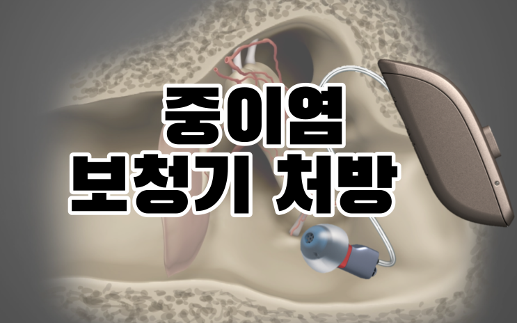  귓속형보청기 중이염증이 있다면 어떤 문제가 생길까요?
