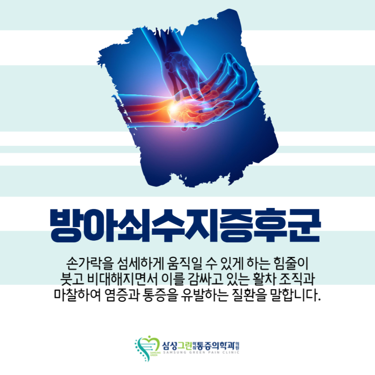  '일산 정형외과' 방아쇠수지증후군, 이러한 증상이 있다면 의심해봐야 합니다.