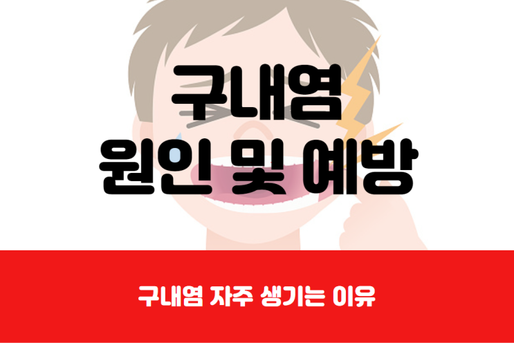  구내염 자주 생기는 이유
