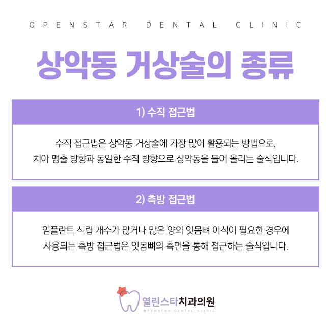 Multi-Sinus Dental 상악동 리프팅 치과를 선택하는 것이 왜 중요한가요? 9