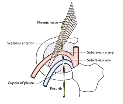 쇄골하 정맥 중심관, Subclavian vein catheterization 위치와 준비물, blind 하게 잡는 법