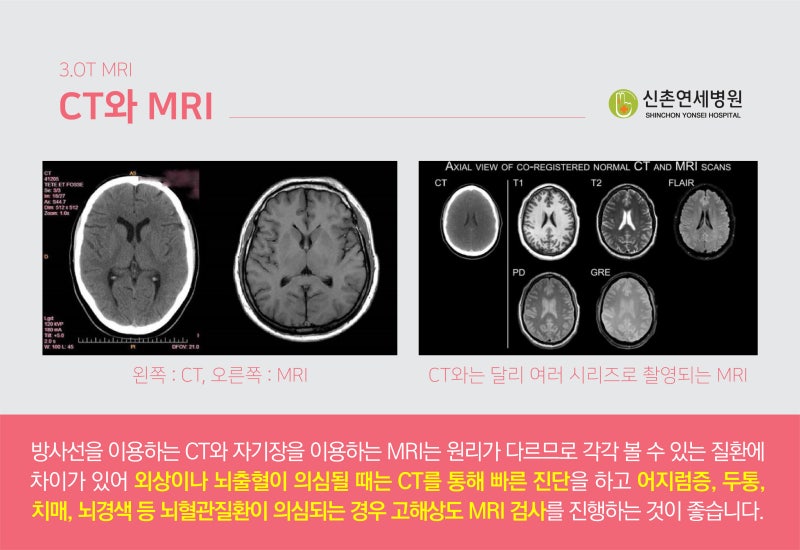 은평구 뇌 CT, MRI, MRA 검사, 왜 찍어야 할까? : 네이버 블로그
