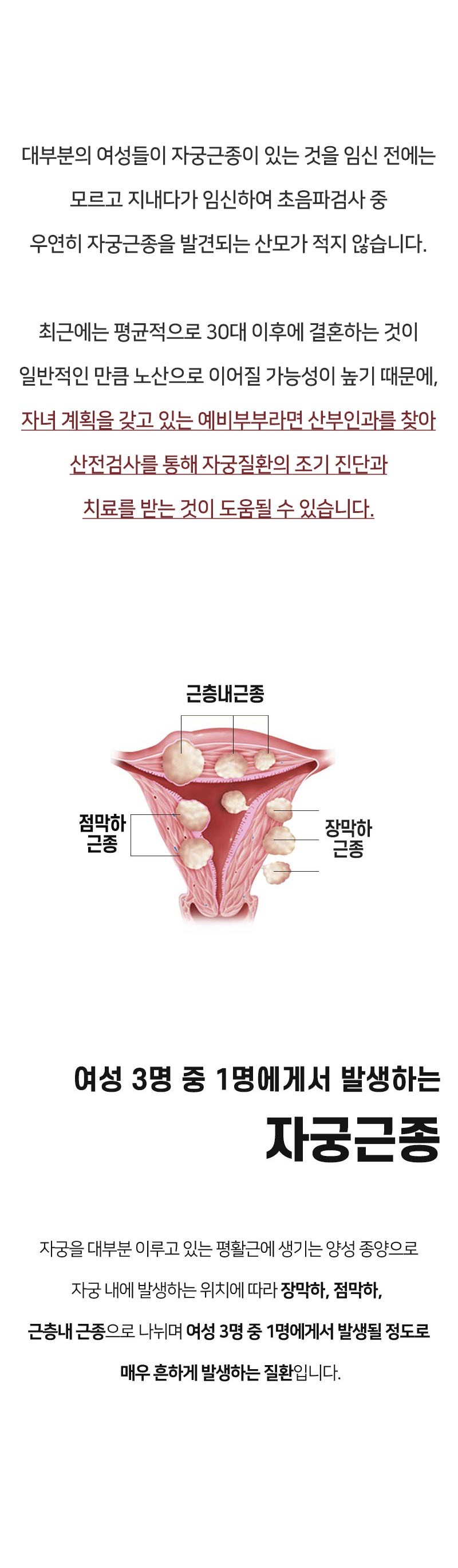 임신 중 자궁근종 하이프 시술 가능한가요?