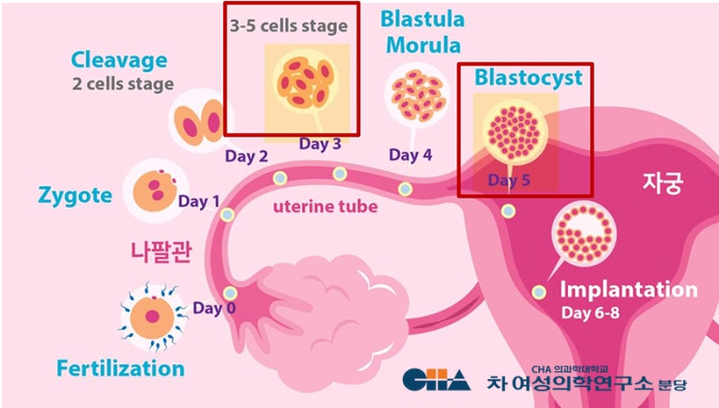 인공 수정: 체외 시술과 어떻게 다릅니까? 임신 성공률은?