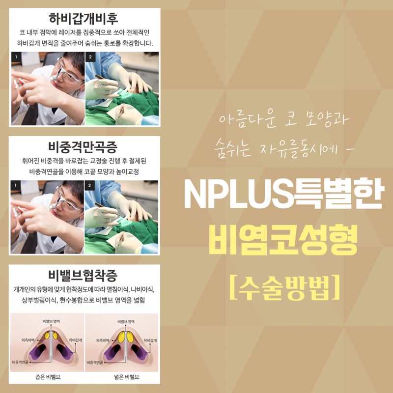 꼼꼼한 코성형 코성형 리뷰