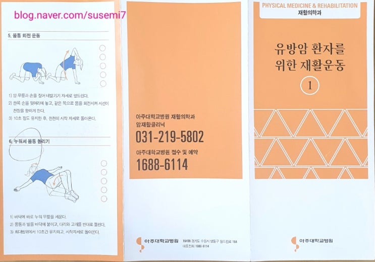  유방암 수술 후 재활과 방사선