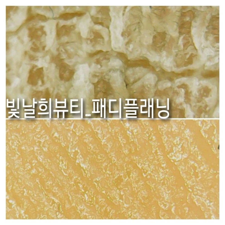  양산부산 패디플래닝 광학줌렌즈로 발상태 확인하기