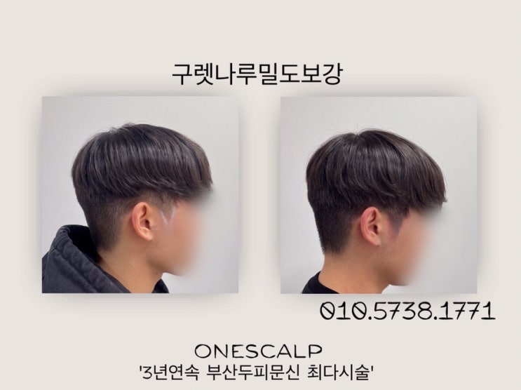  부산구렛나루두피문신 원스칼프에서 !
