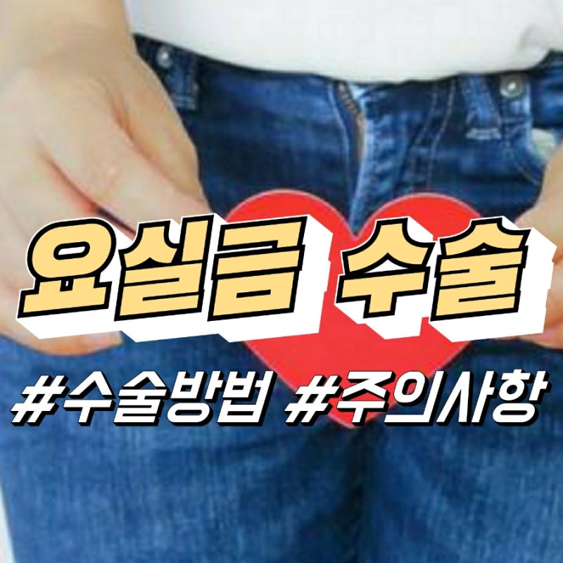 복압성 요실금 수술 방법, 주의사항
