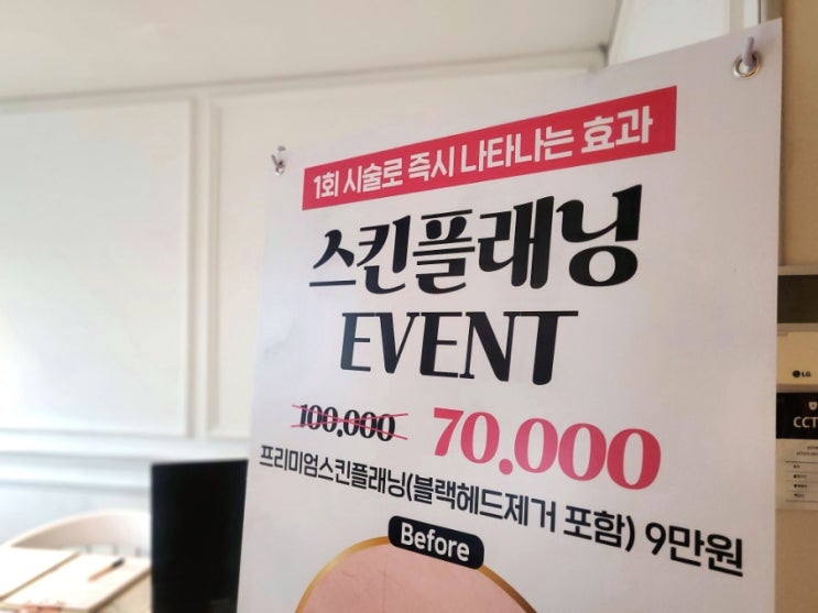  얼굴잔털제거 후 톤업효과 최고! 강남 스킨플래닝