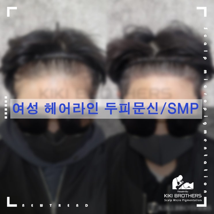  노원두피문신, 여성 탈모커버 전문점 키키브라더스 노원