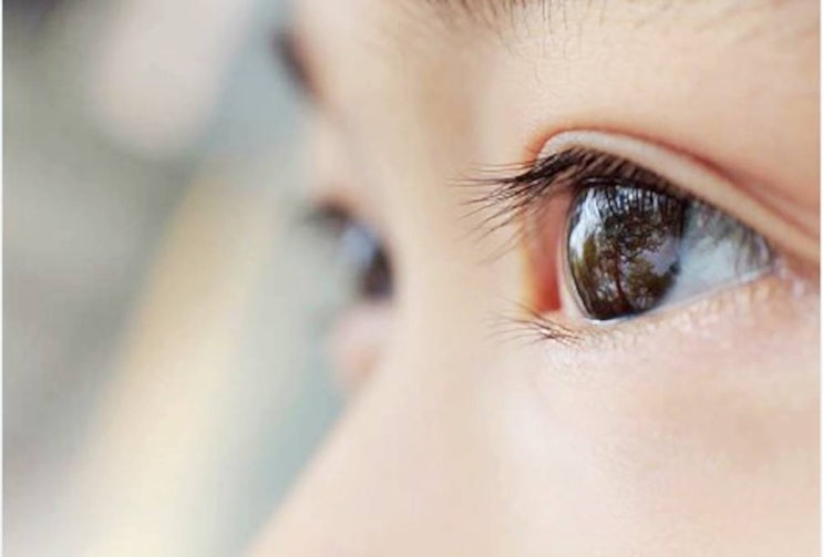 눈 비문증 : 증상과 치료방법