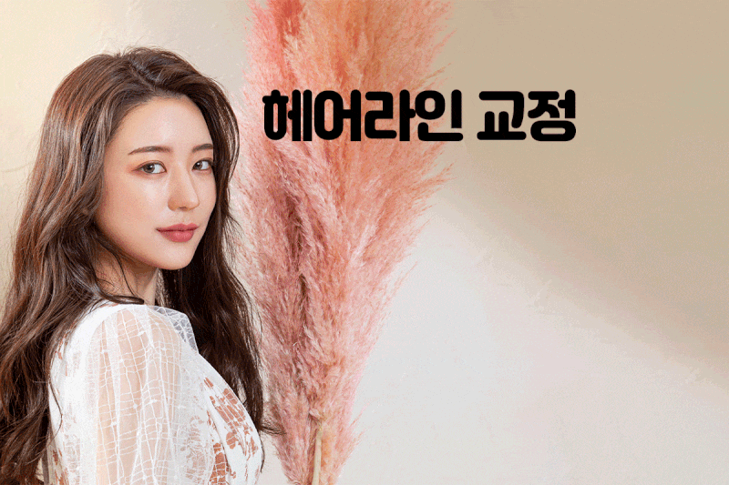 대구헤어라인 교정에 탁월한 선택을 2