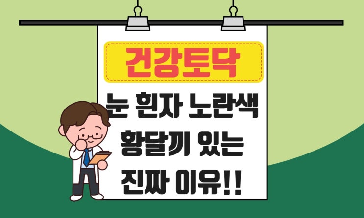  눈 흰자 노란색 원인, 안구 황달