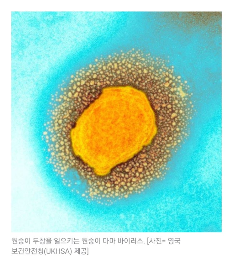  원숭이두창 원인, 증상, 치료까지 확인 하세요~